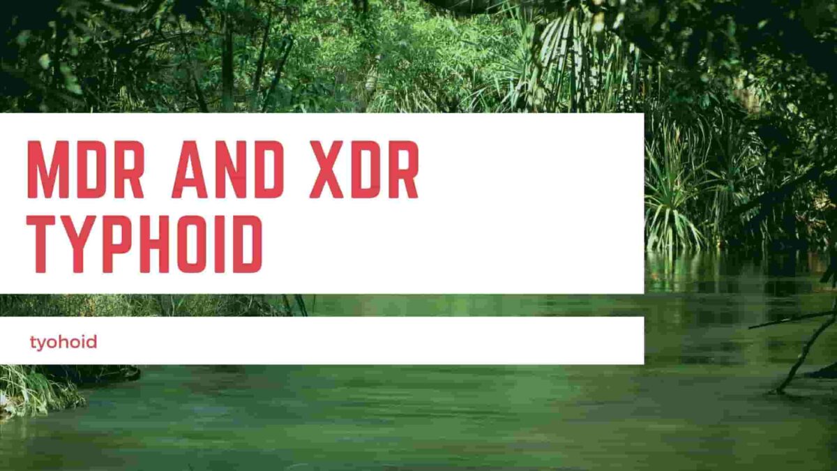 MDR and XDR typhoid is emerging recently with resistant to multiple first line antibiotics, creating a problem in treatment.